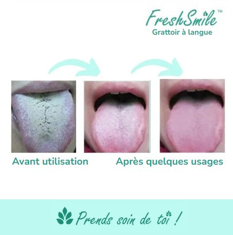 FreshSmile™ | Soins Quotidiens | Grattoir à langue | acier inoxydable